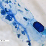 arbuscular mycorrhiza