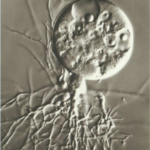 chytrid fungus